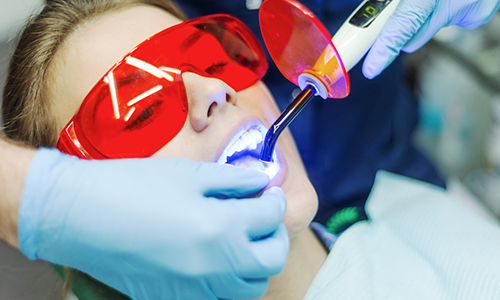 Laser-Dentistry